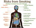 Change already? |  In message , Steven Pampling  wroteThe smoking industry campaigned in a way that...